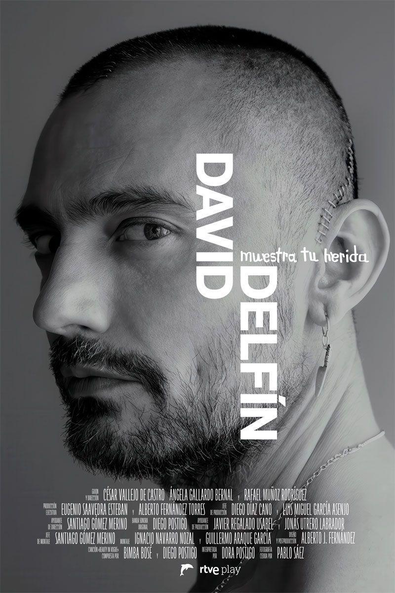 David Delfín. Muestra tu herida